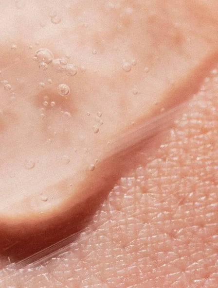 Oil-Free Hydrating Gel (Aloe-Based)