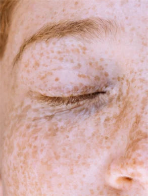 Stable Vitamin C Serum with Ferulic Acid